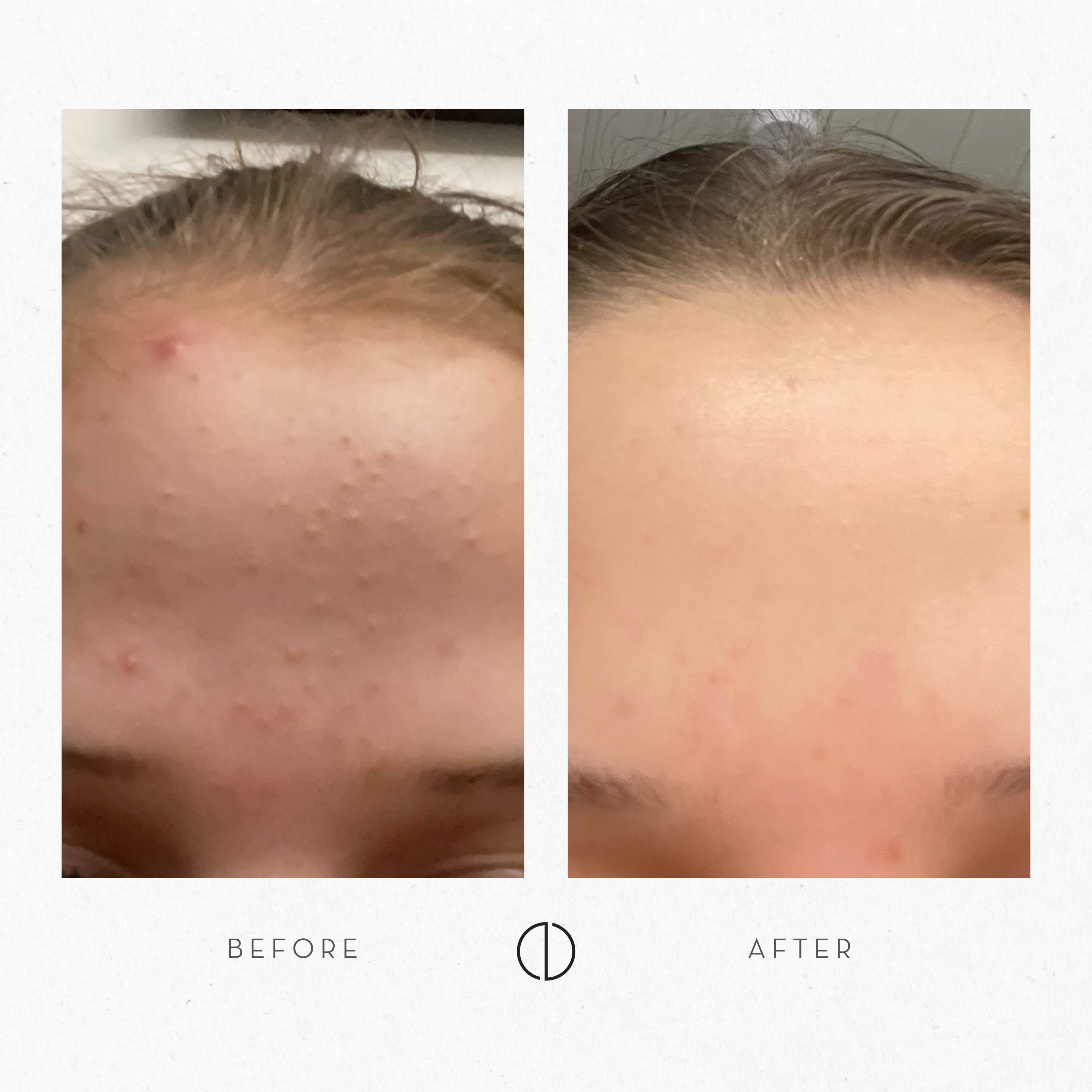 Sointu & Dry, sensitive skin